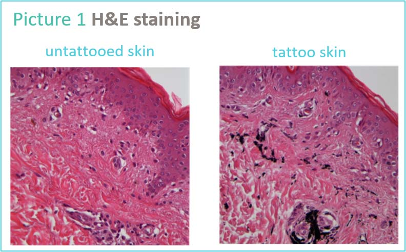 tattoo-h&e-staining.jpg