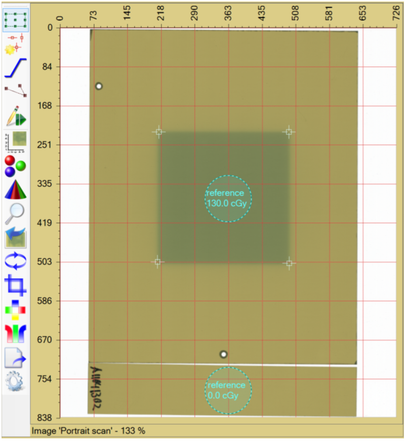 Image showing fiducial management tool with calibration rescaled.