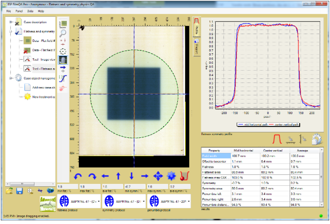 Chart of the profiles along the selected analysis path lines and a table with the numerical analysis data according to the selected analysis protocols for flatness, symmetry and penumbra.