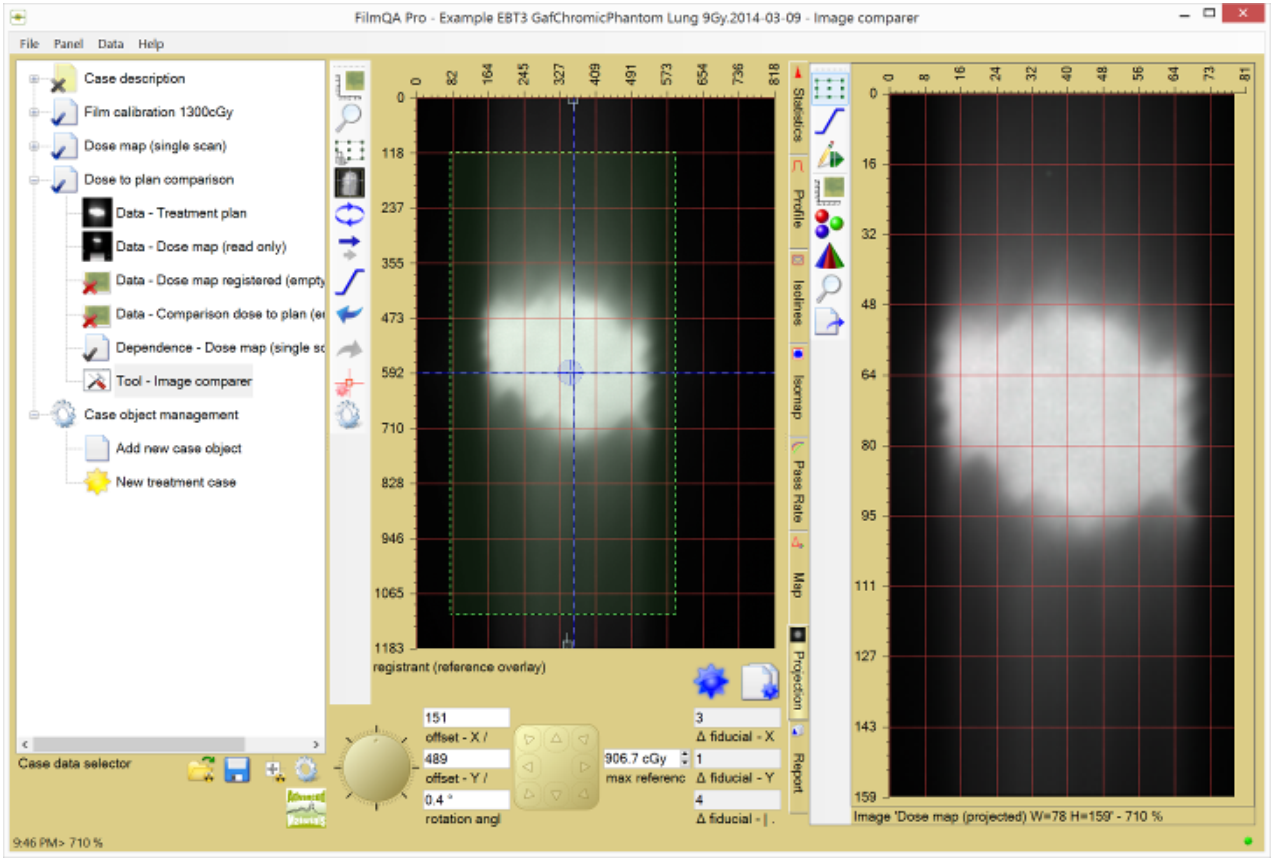 Graphic showing the recalculated dose map after any change.