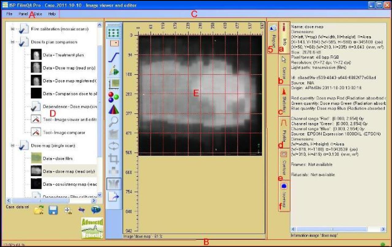 Screenshot of image view and edit panel.