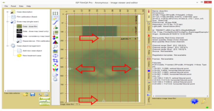 Screenshot of fiducial assignment interface.