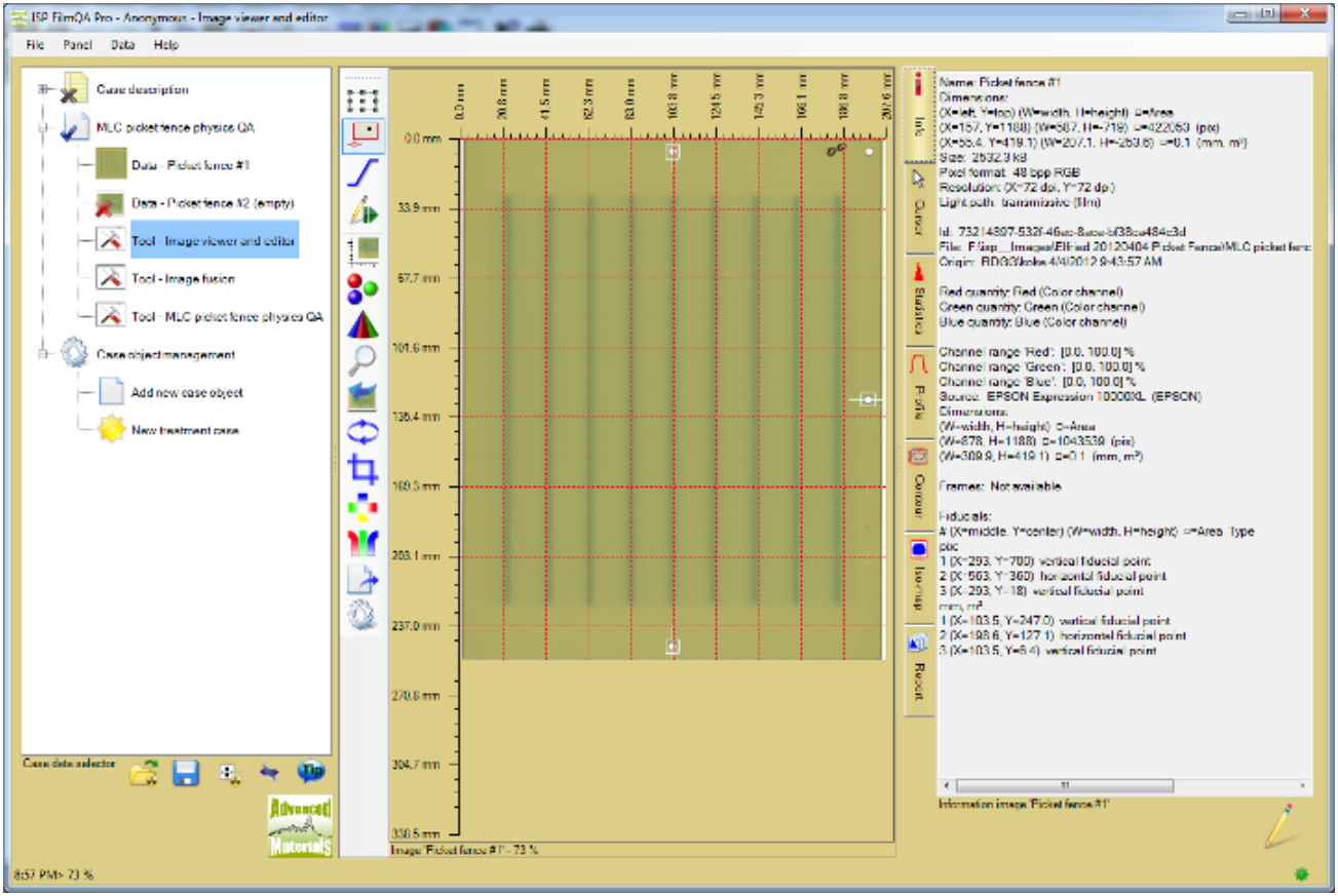 Screenshot of the fiducial marker on the Image Registration screen.