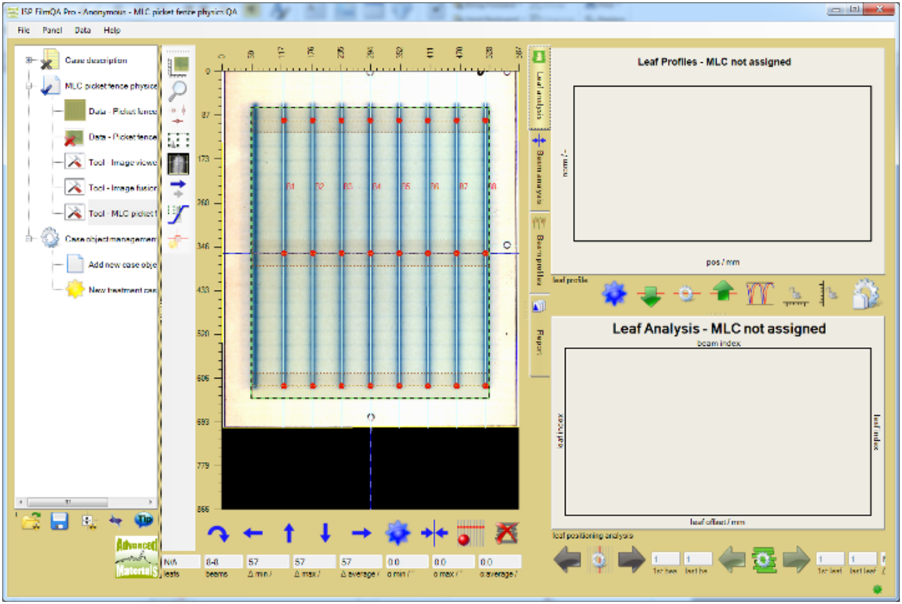Screenshot of MLC picket fence physics QA tool.