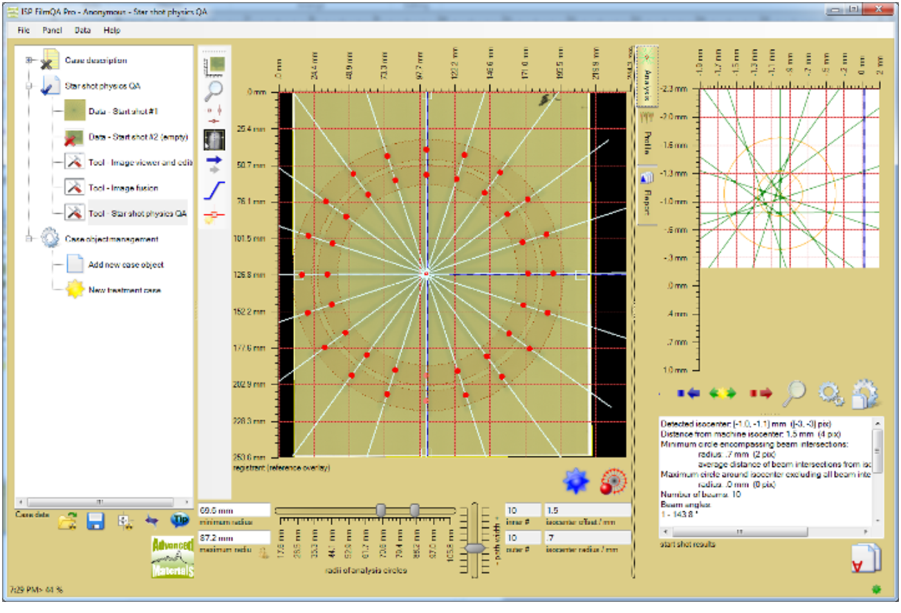 Screenshot showing the magnification of the beam intersection area and the smallest circle including all beam intersection.